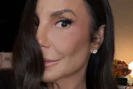 Ivete Sangalo surge com hematoma no rosto e brinca sobre aparência - Imagem