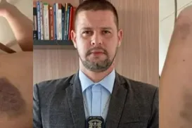 Justiça suspende porte de arma de delegado suspeito de agredir ex - Imagem