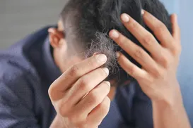 Minoxidil pode causar impotência? Veja o que dizem especialistas - Imagem