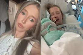 Mulher é atacada por cachorro e fica com rosto desfigurado - Imagem