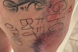 Mulher é torturada, tatuada à força e agredida por companheiro - Imagem