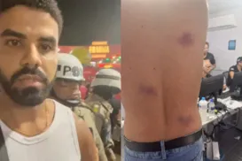 PMs são afastados após denúncia de agressões e homofobia no Carnaval - Imagem