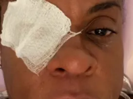 Atriz global desabafa após perder visão com pomada: "Dor avassaladora" - Imagem