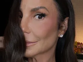 Ivete Sangalo surge com hematoma no rosto e brinca sobre aparência - Imagem