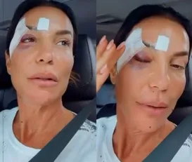 Ivete Sangalo recebe alta médica após desmaiar e ser internada - Imagem