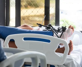 Bahia teve gasto de quase R$ 150 milhões com acidentes de moto em 2025