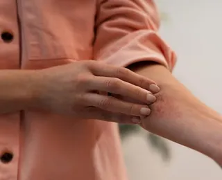 Coceira no corpo após banho quente e exercício: saiba quando se preocupar