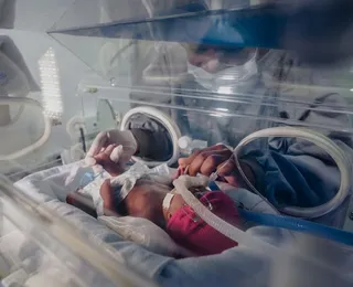 Composto plástico pode ter ligação com 2 milhões de partos prematuros