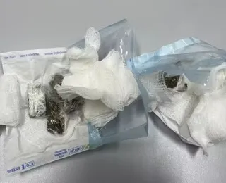 Dentista é presa por entregar drogas escondidas em gaze em presidio