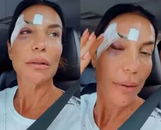 Ivete Sangalo recebe alta médica após desmaiar e ser internada