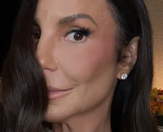 Ivete Sangalo surge com hematoma no rosto e brinca sobre aparência
