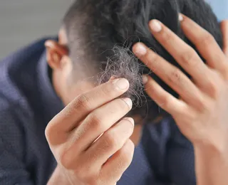 Minoxidil pode causar impotência? Veja o que dizem especialistas