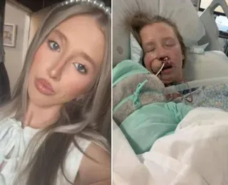 Mulher é atacada por cachorro e fica com rosto desfigurado