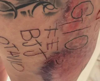 Mulher é torturada, tatuada à força e agredida por companheiro