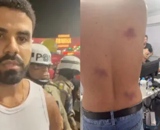 PMs são afastados após denúncia de agressões e homofobia no Carnaval