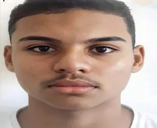 Raiva humana: adolescente de 17 anos morre após mordida de sagui
