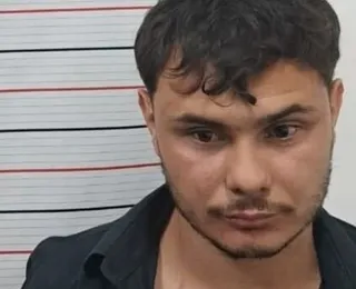 Vídeo: homem morde e arranca parte da orelha da companheira em festa
