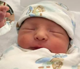 Bebê com "barbatana da sorte" viraliza nas redes sociais