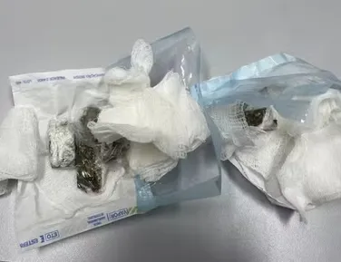 Dentista é presa por entregar drogas escondidas em gaze em presidio - Imagem