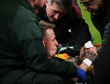 Jogador sofre acidente e quase perde dedo na Champions League; confira - Imagem