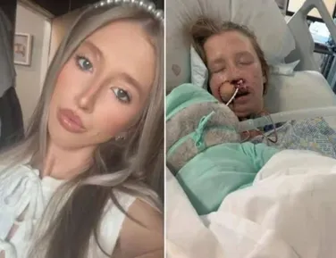 Mulher é atacada por cachorro e fica com rosto desfigurado - Imagem