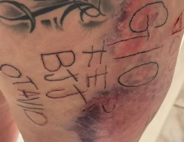 Mulher é torturada, tatuada à força e agredida por companheiro - Imagem