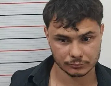 Vídeo: homem morde e arranca parte da orelha da companheira em festa - Imagem