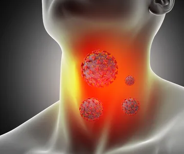Advogado descobre câncer após ignorar caroço no pescoço - Imagem