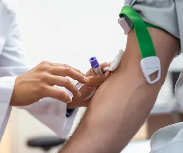 Alzheimer pode ser identificado por novo exame de sangue; entenda - Imagem