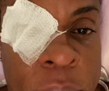 Atriz global desabafa após perder visão com pomada: "Dor avassaladora" - Imagem