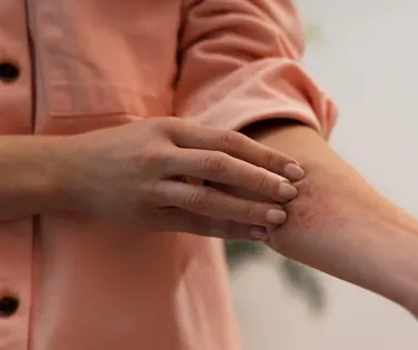 Coceira no corpo após banho quente e exercício: saiba quando se preocupar - Imagem