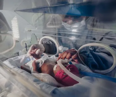 Composto plástico pode ter ligação com 2 milhões de partos prematuros - Imagem