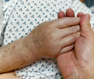 Conheça 10 países em que é possível cometer eutanásia - Imagem