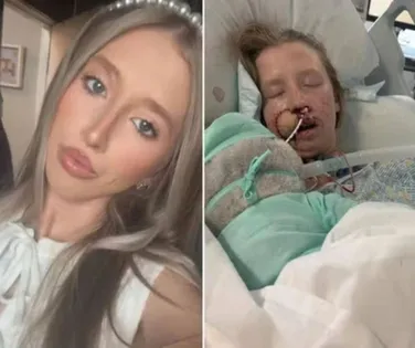 Mulher é atacada por cachorro e fica com rosto desfigurado - Imagem