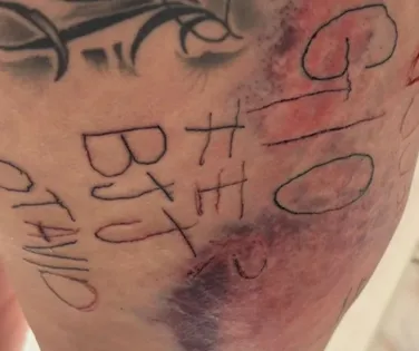 Mulher é torturada, tatuada à força e agredida por companheiro - Imagem