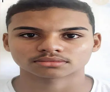 Raiva humana: adolescente de 17 anos morre após mordida de sagui - Imagem
