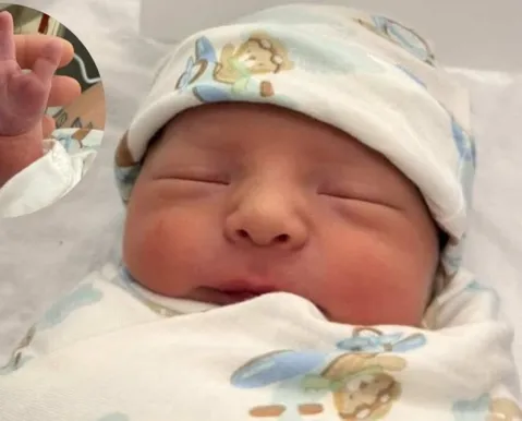 Bebê com "barbatana da sorte" viraliza nas redes sociais - Imagem