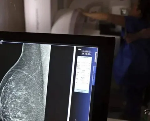 Teste genético que prevê risco de câncer de mama será feito no SUS - Imagem
