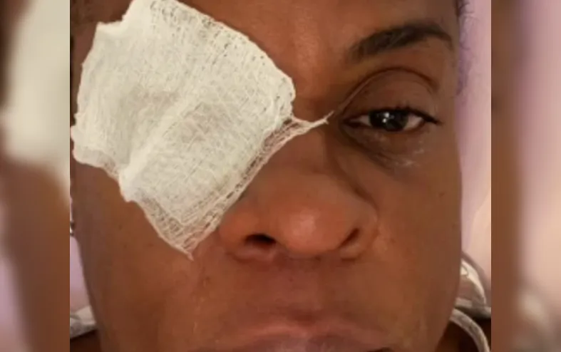 Atriz global desabafa após perder visão com pomada: "Dor avassaladora" - Imagem