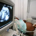 Aborto espontâneo: por que acontece e quando investigar? imagem