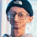 Aos 28 anos, morre influenciador com doença genética rara imagem