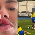 Cantor critica ex-jogador do Bahia após apanhar em jogo festivo; veja imagem