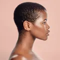 Dermatite seborreica pode provocar queda de cabelo em pessoas negras imagem