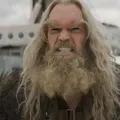É possível? Ator de X-Men é diagnosticado com câncer de mama; confira imagem