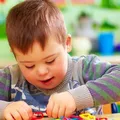 Evolução do cérebro humano pode explicar risco de autismo imagem