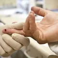 HIV terá maioria de pacientes acima dos 50 anos até 2040 imagem