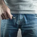 Homem com menor pênis do mundo passa por procedimento para aumentar órgão imagem
