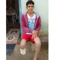 Homem que amputou o próprio pé havia feito quatro seguros dias antes da fraude imagem