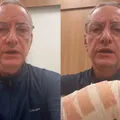 Jornalista da Globo é atacado por pitbull e mostra ferimentos; assista imagem
