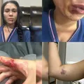 Juiz afasta tentativa de feminicídio após mulher ser esganada e agredida imagem
